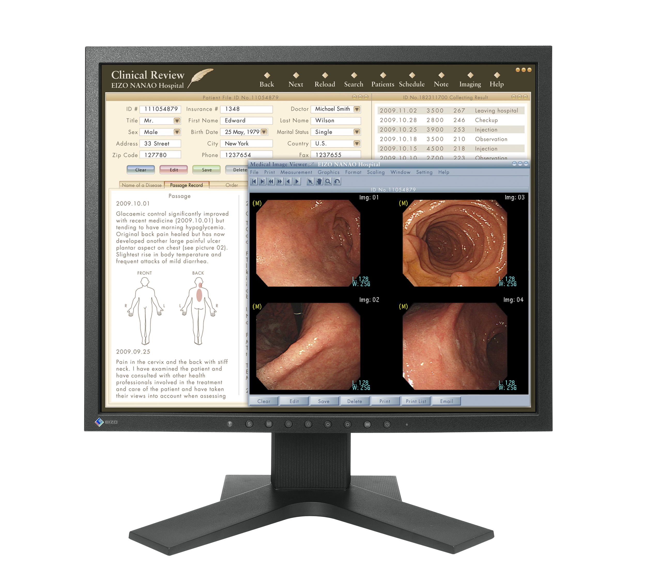 19 Inch Medical Monitor for DICOM Part 14 Calibration