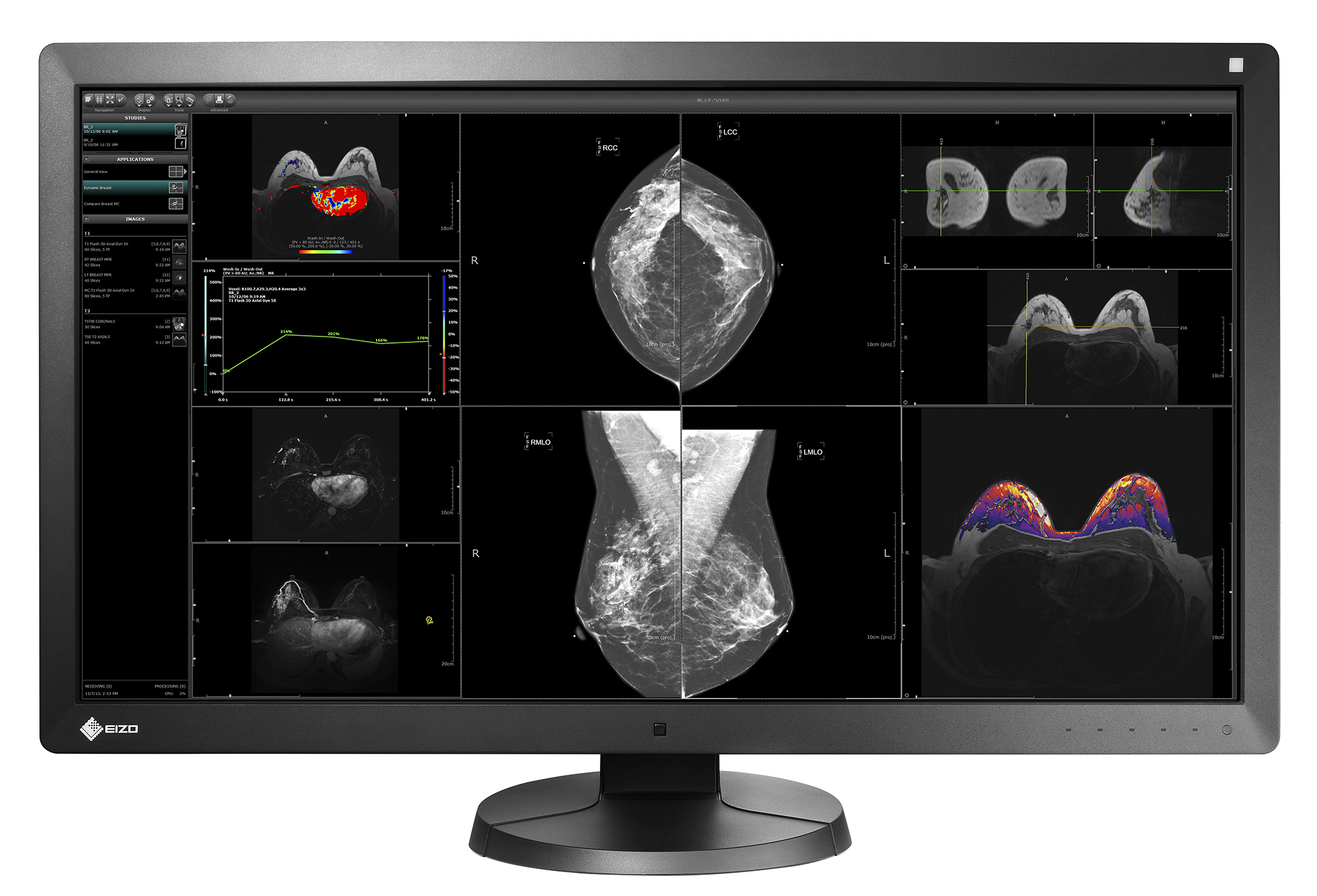 eizo radiforce